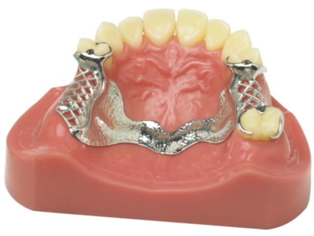 钛合金牙齿支架价格突破神奇独具魅力的新选择，让你笑容更亮眼