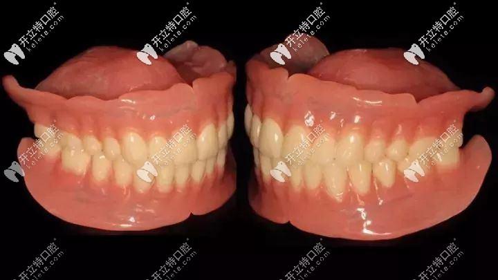 固定义齿磨牙减少牙齿寿命吗